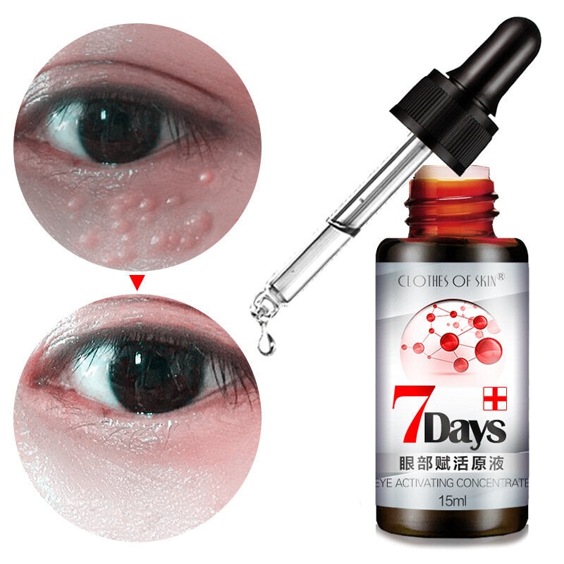 Revitalizing Eye Essence Liquid Fade Dark Circle Eye Bag Remove Fat Granule Essence Face